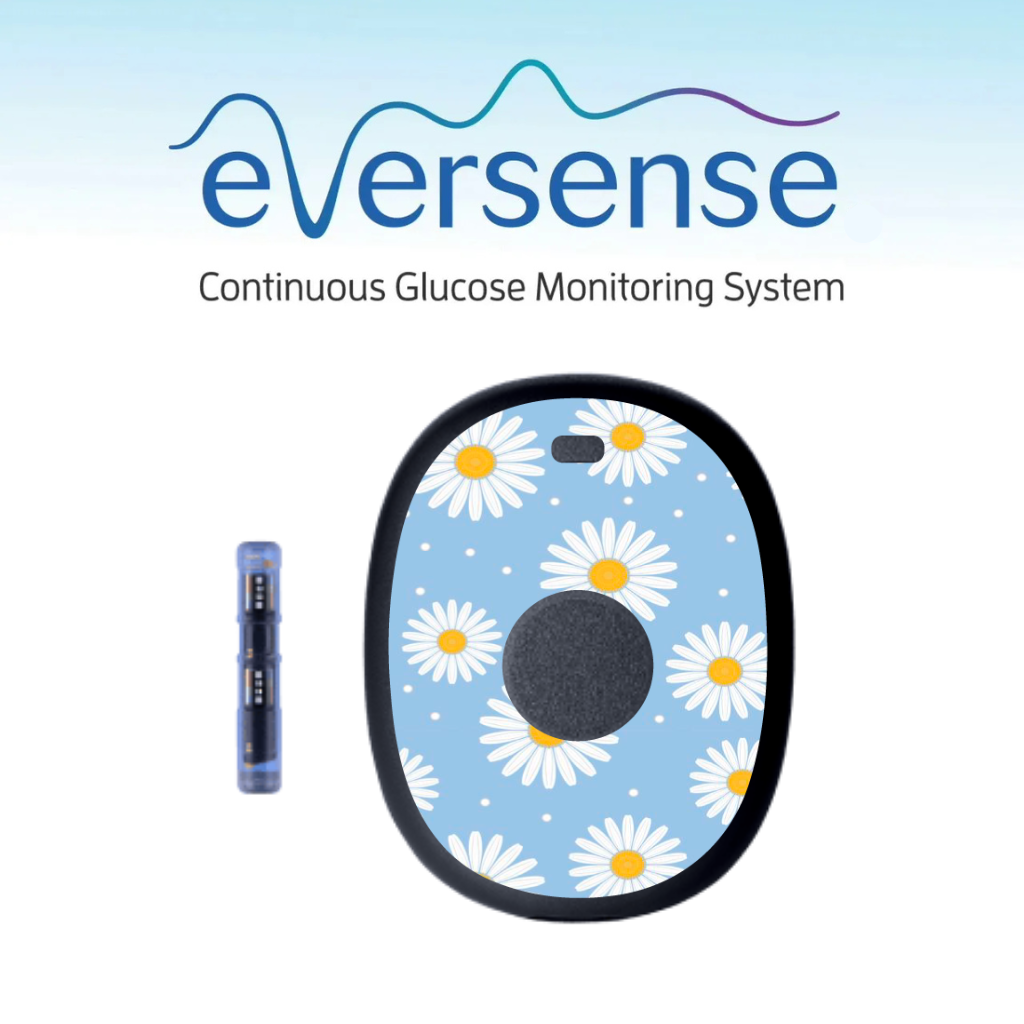 Eversense 365